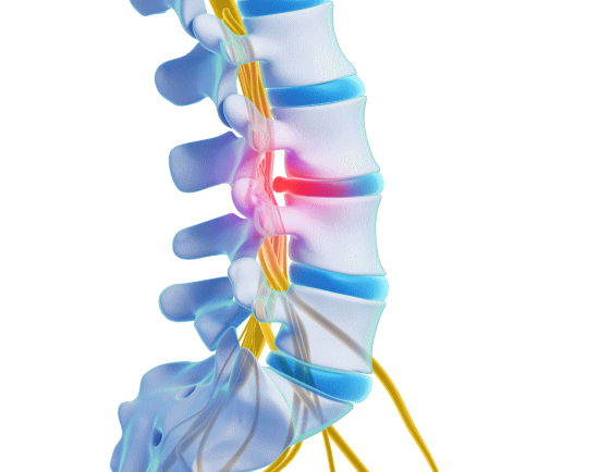 椎間板ヘルニアと坐骨神経痛にはカイロプラクティック、整体、整骨院の骨格矯正が最適です（浜松市）