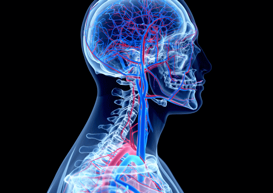 偏頭痛（片頭痛）と首の血管を圧迫する頸椎の歪みを矯正するカイロプラクティック、整体、整骨院の骨格矯正