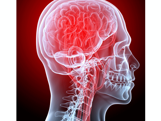 偏頭痛（片頭痛）の症状と痛みを改善する、整体、カイロプラクティック、整骨院